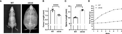 The Role of Estrogen Receptor α in Response to Longitudinal Bone Growth in ob/ob Mice